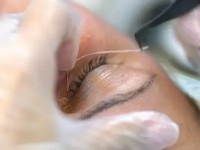 DS V-Line Collagen Rope Protocol DS V-Line Collagen Rope Protocol