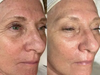 Anti-aging kezelések