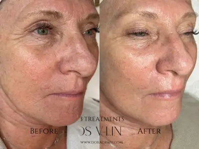 Kozmetika - Anti-aging